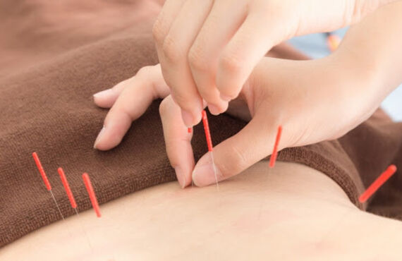 神保町で安心して針治療の施術が受けられる施設をお探しの方を歓迎します